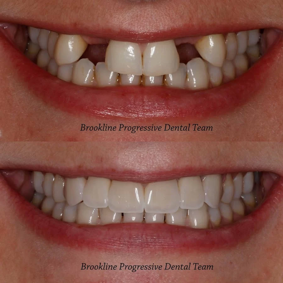 Brookline Progressive Dental Team Picture 7
