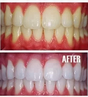 Valley Road Dental Excellence: Scott B. Schaffer, DMD Picture 2