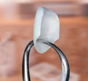 DR RAJDEEP S RANDHAWA, B.D.S, D.D.S LASER, BIOMIMETIC, COSMETIC DENTISTRY Picture 1