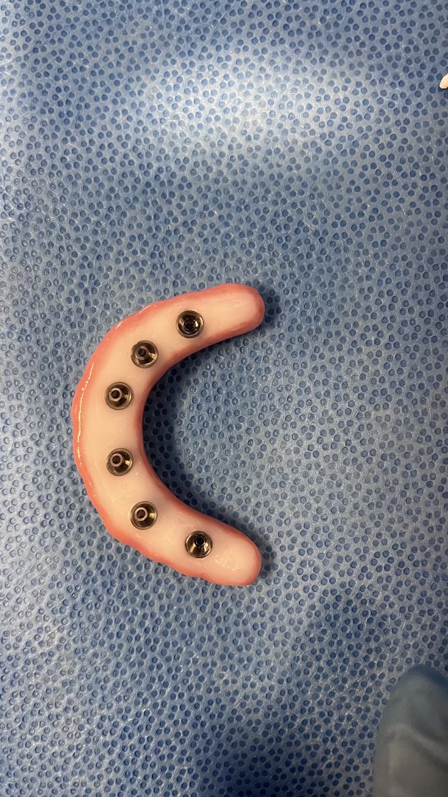 Affordable Dentures & Implants Picture 10