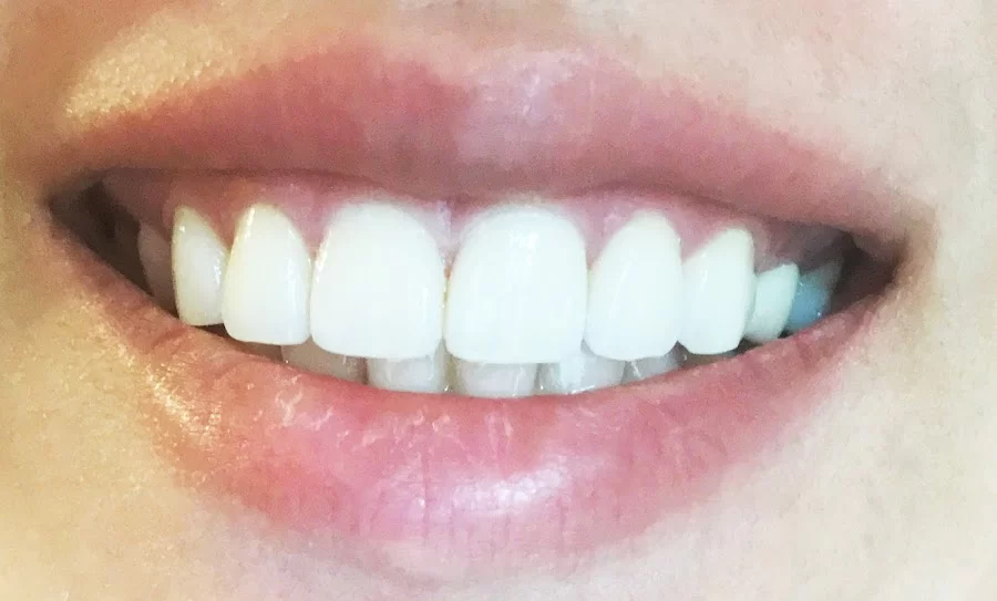 Hollywood Smile Dental Picture 3