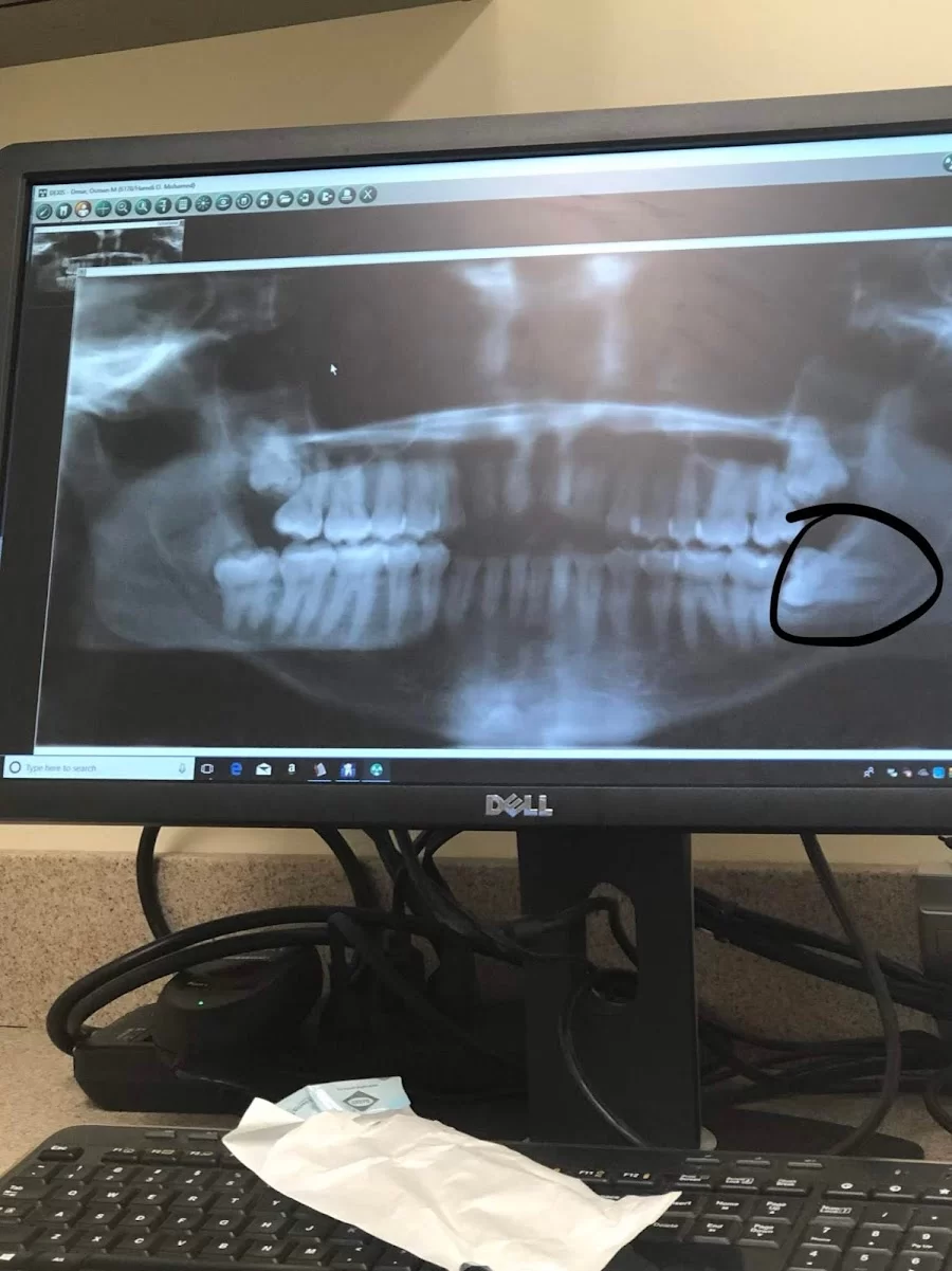 Clevemorse Family Dentistry Picture 1