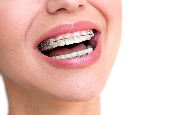 All Family Dental Care Picture 1