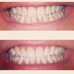 Caring Tooth Dental Clinic Northridge
