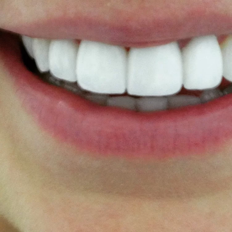 Caring Tooth Dental Clinic Northridge Picture 6