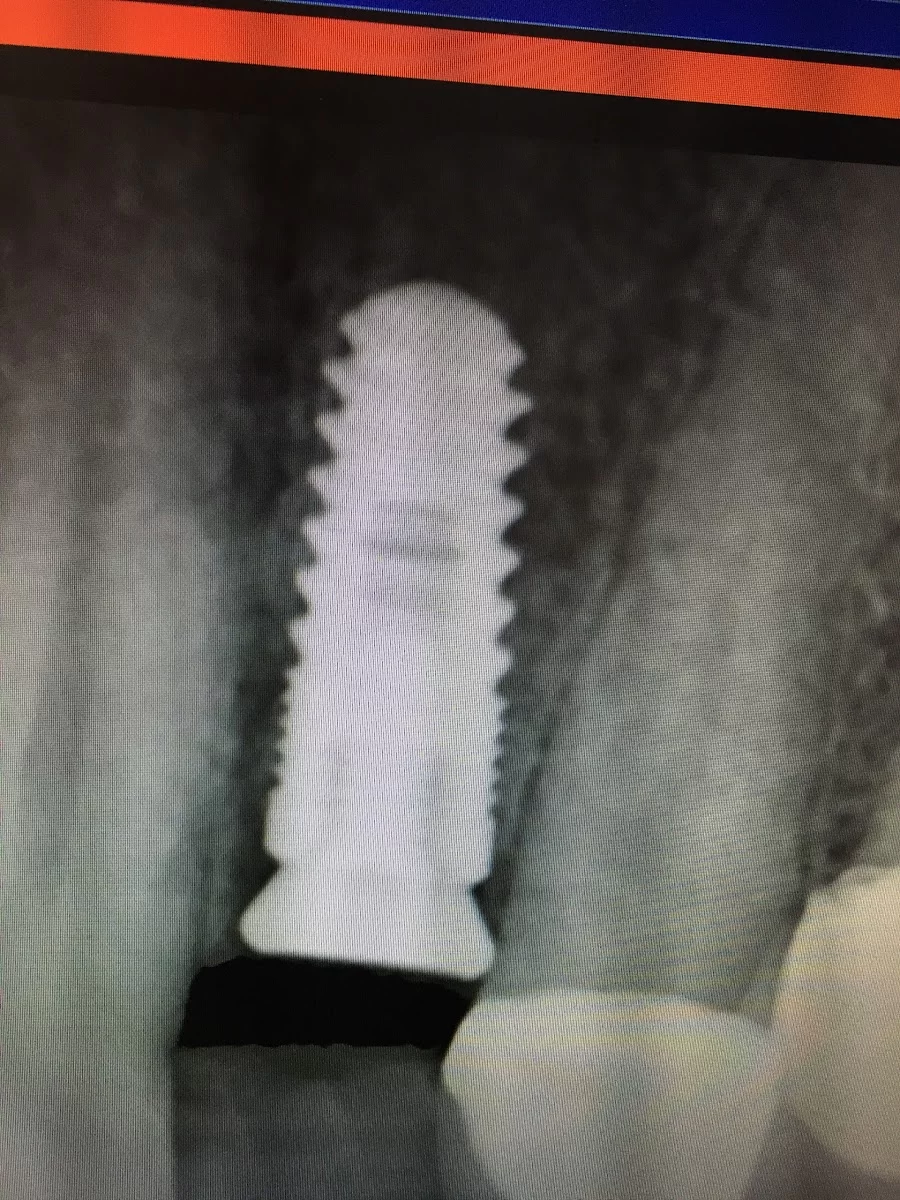 Caring Tooth Dental Clinic Northridge Picture 10