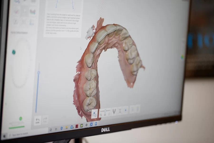 Personalee Dental Picture 2