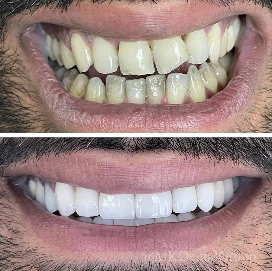 MK Dental Group Picture 7