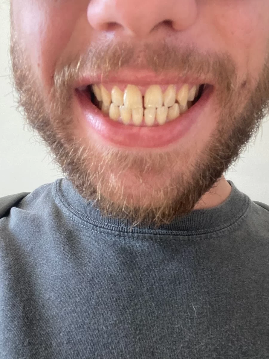 CHD Dental Care Picture 3