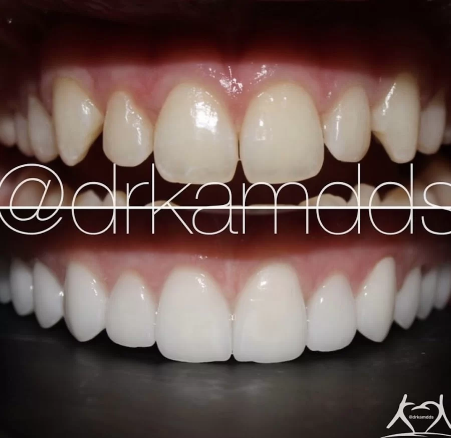 Agoura Advanced Dentistry - Dr. Kambiz Kamangar DDS Picture 9