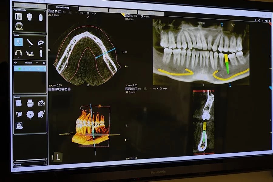 Robert G. Hale DDS Implant Center Picture 8