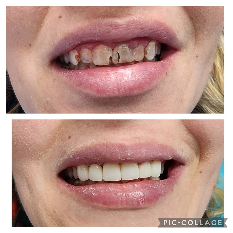Perfect 32 Dental Care Picture 7