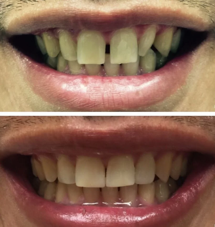 Healthy Smiles Family Dental Picture 3