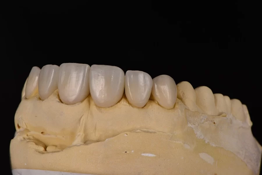 Pristine Dental Service Picture 1