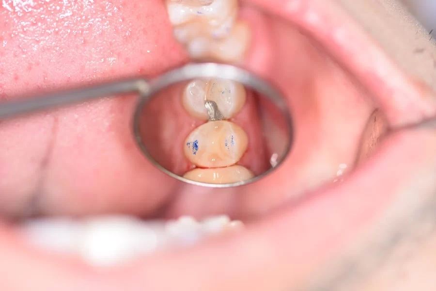 Pristine Dental Service Picture 4