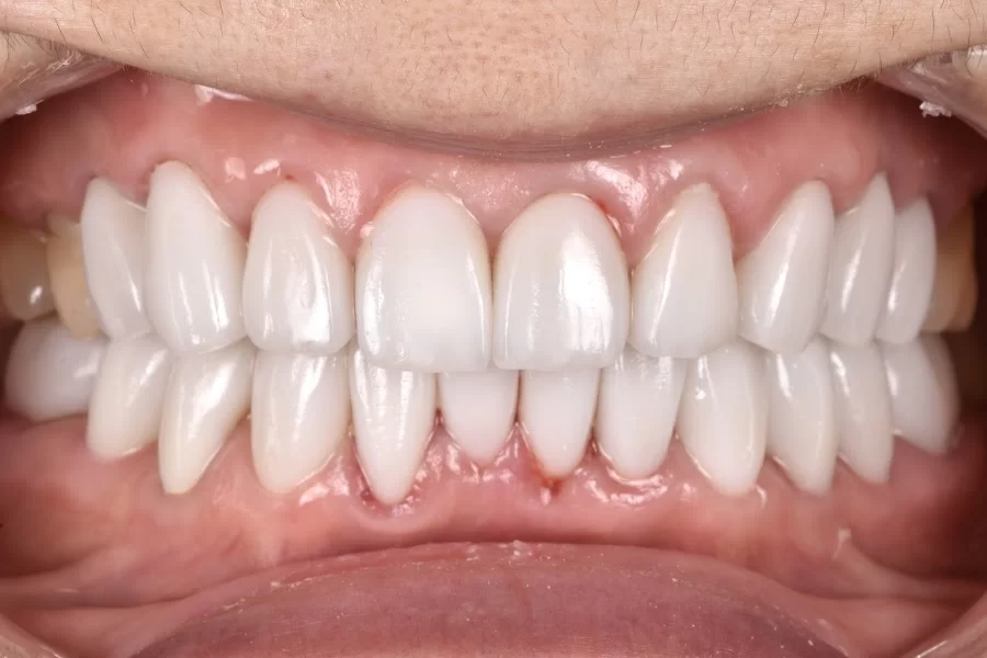Pristine Dental Service Picture 2