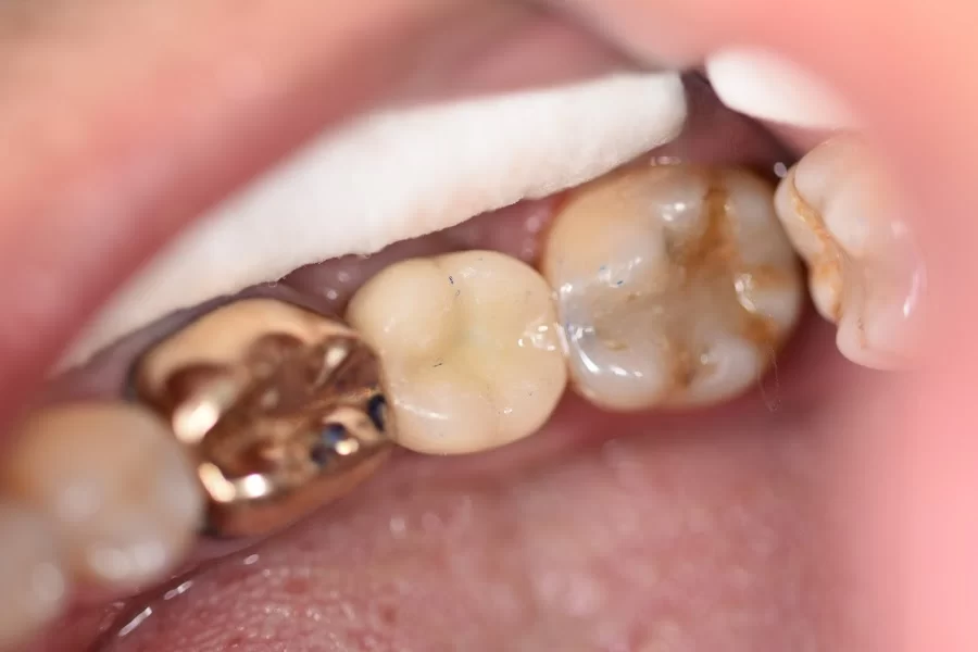 Pristine Dental Service Picture 3