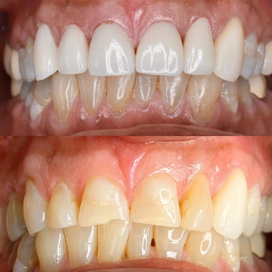 Pristine Dental Service Picture 7