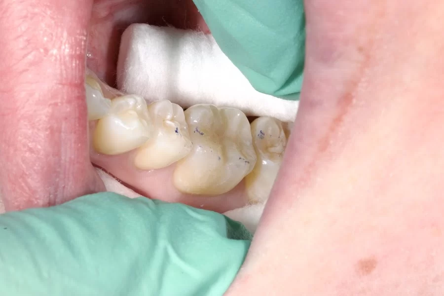 Pristine Dental Service Picture 5