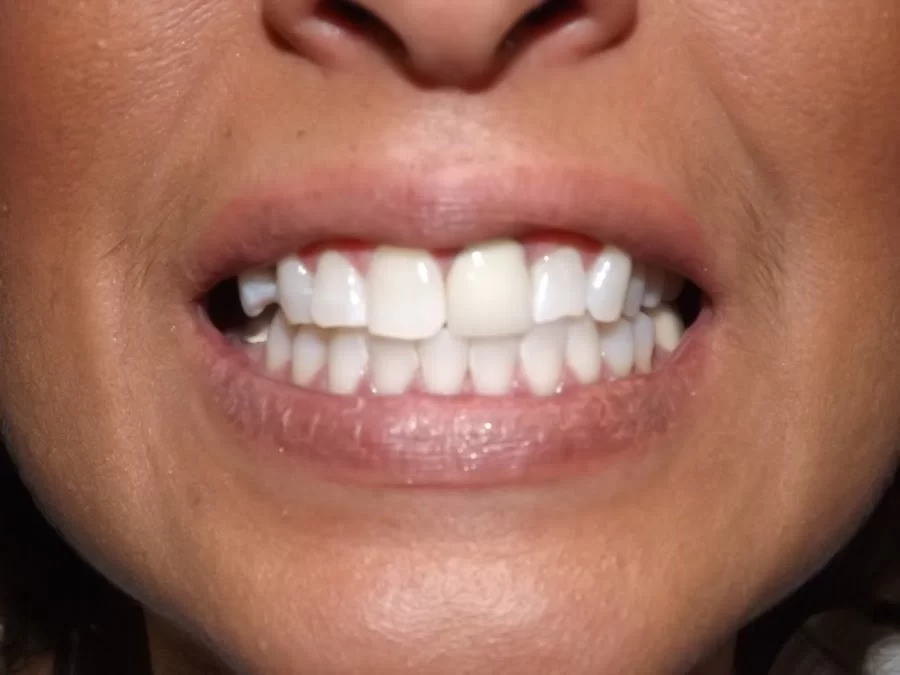 Canyon Dental Picture 4
