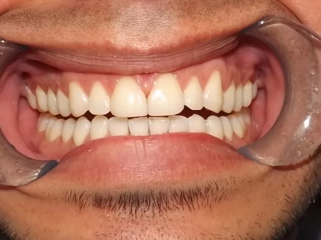 Canyon Dental Picture 2