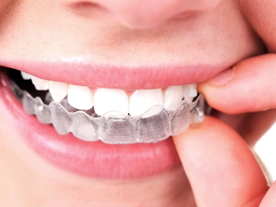 Smile Squad Kids Dentistry & Braces Picture 1