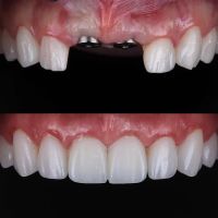 Modern Smiles ico