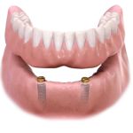 City Dental- Dental Implants and Orthodontics