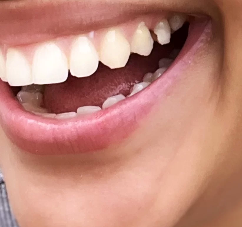 Premier Dental of Edison Picture 4