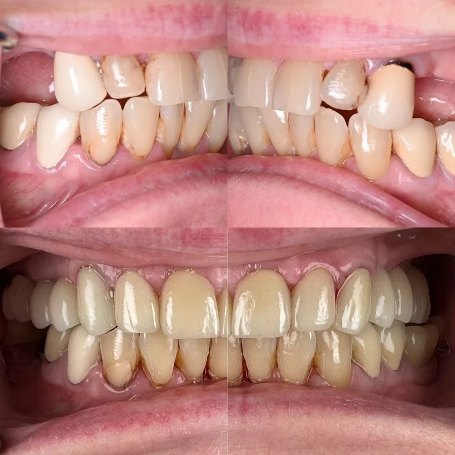 Cal Dental Pasadena Picture 6