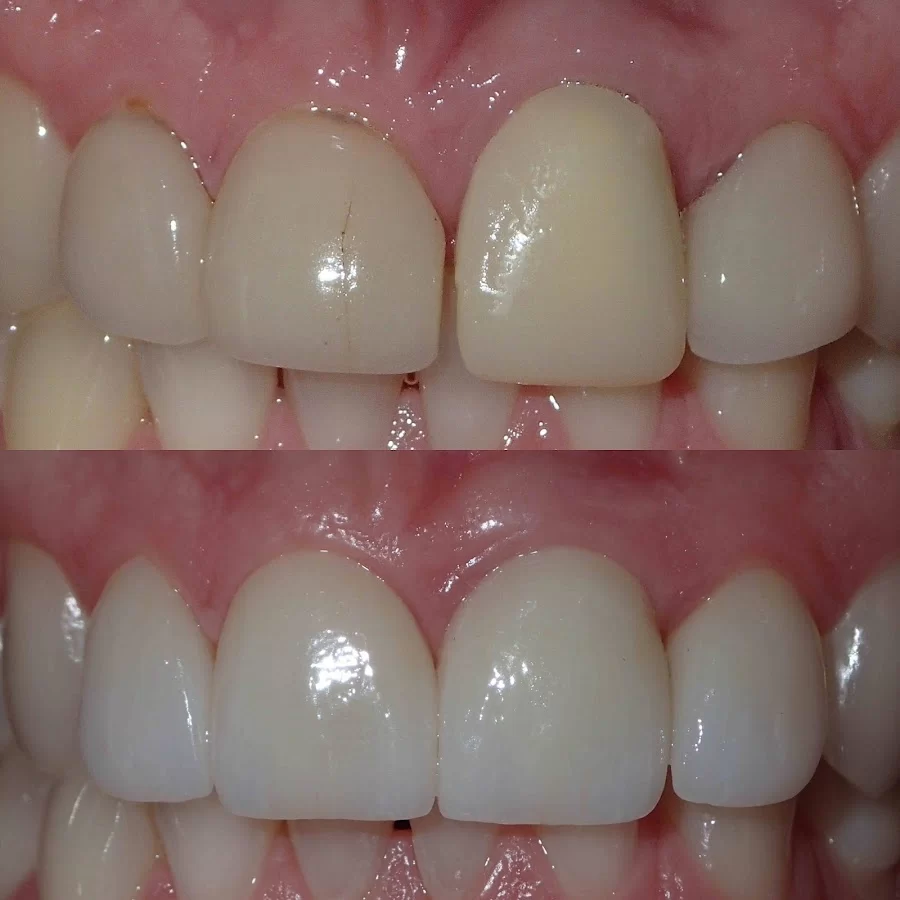 Beverly Hills Periodontal Institute Miles Madison, DDS Picture 7