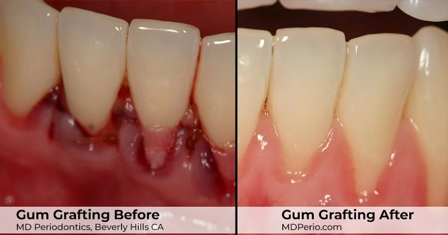 MD Periodontics of Beverly Hills Picture 3