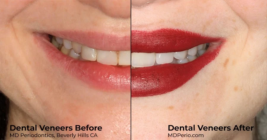 MD Periodontics of Beverly Hills Picture 4