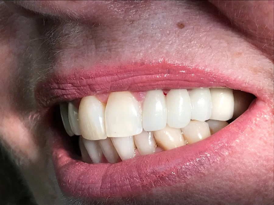 Carey Family Dentistry LLC Picture 9