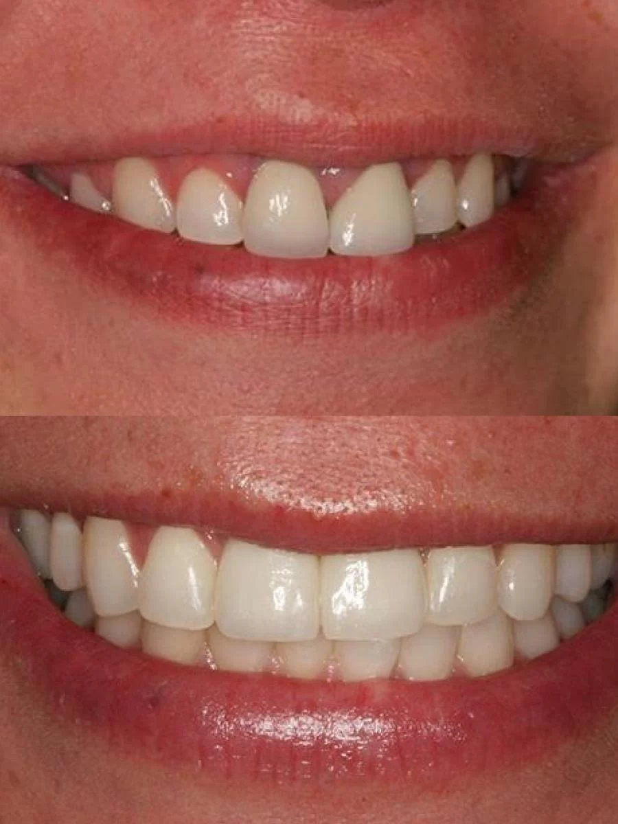 Saghi Parham D.D.S. - Beverly Hills Cosmetic & Restorative Dentistry Picture 9