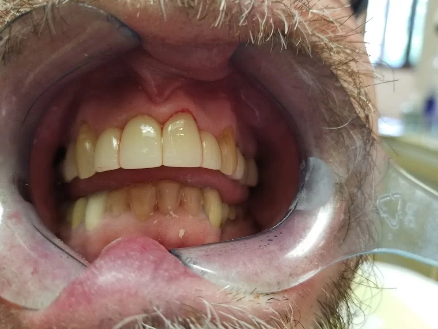 Carey Family Dentistry LLC Picture 4