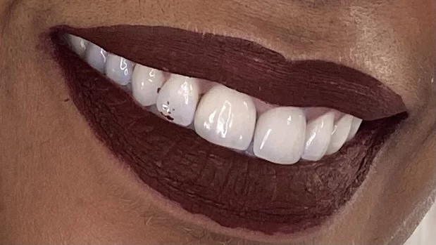 Saghi Parham D.D.S. - Beverly Hills Cosmetic & Restorative Dentistry Picture 4