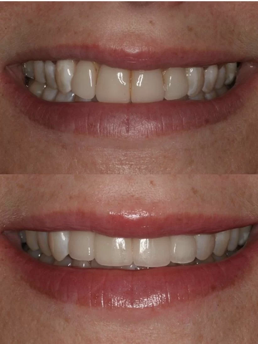 Saghi Parham D.D.S. - Beverly Hills Cosmetic & Restorative Dentistry Picture 8