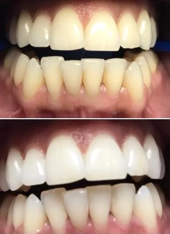 Carey Family Dentistry LLC Picture 2