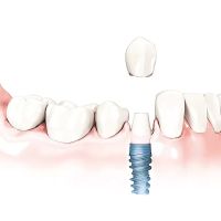 Sayreville Dental ico