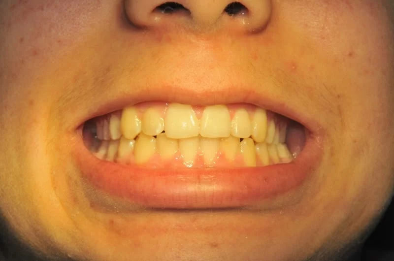 Dentista Franciss Zamora DDS Picture 7
