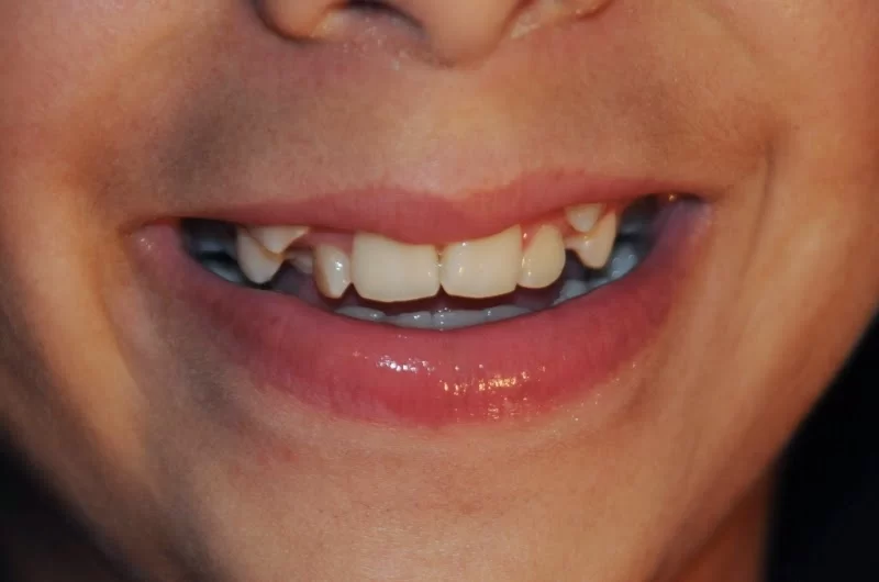 Dentista Franciss Zamora DDS Picture 1