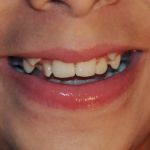 Dentista Franciss Zamora DDS