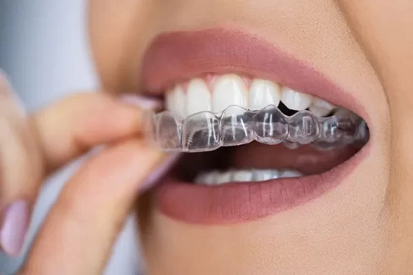 Dentistry By Design Picture 2