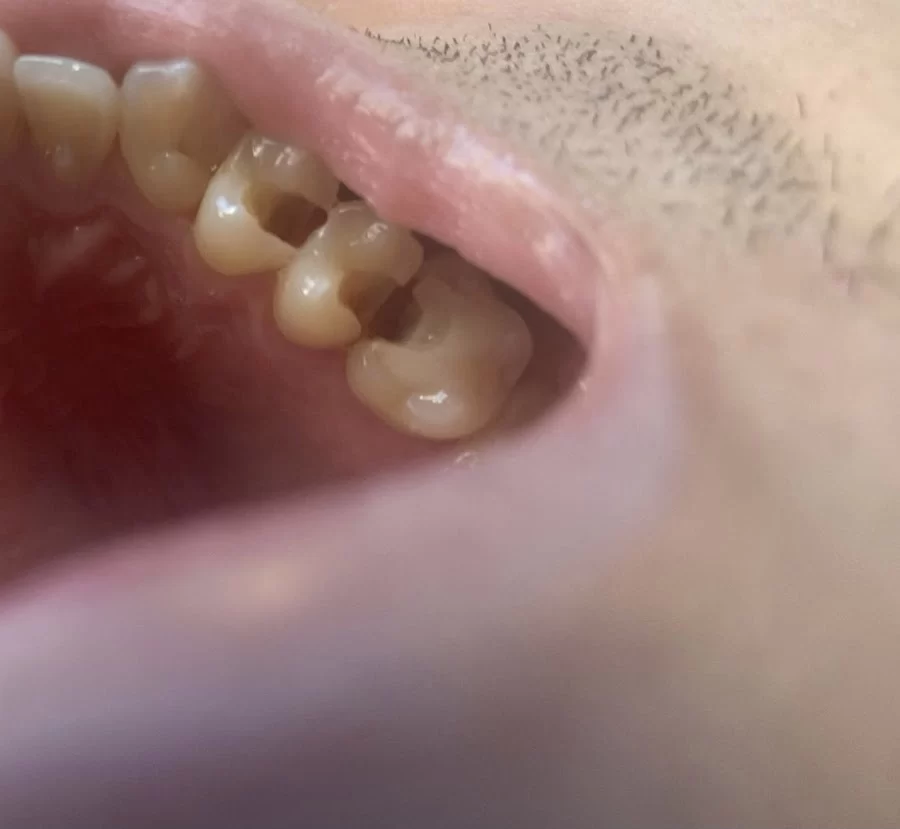 Fraser Dentistry Picture 3