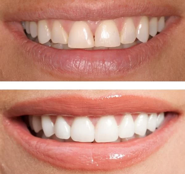 Fraser Dentistry Picture 1
