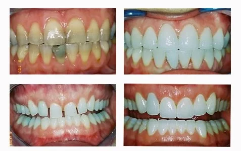 Dr. Bruce King DDS Picture 2