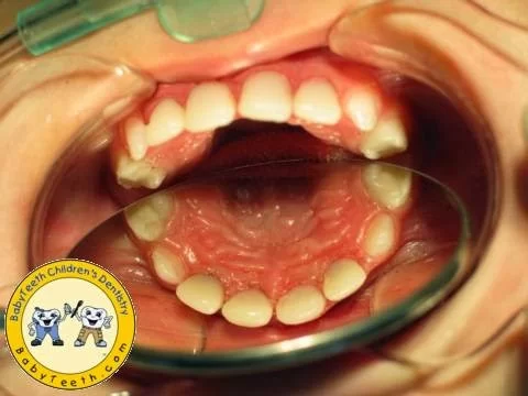 BabyTeeth Children's Dentistry Picture 1
