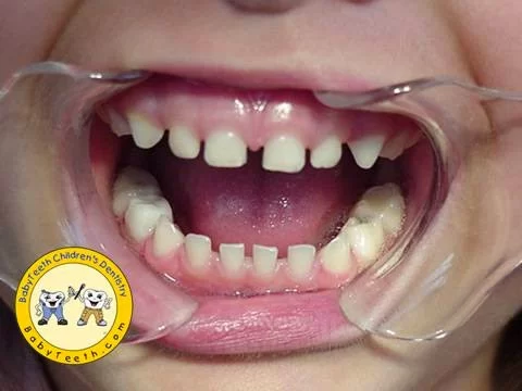 BabyTeeth Children's Dentistry Picture 2