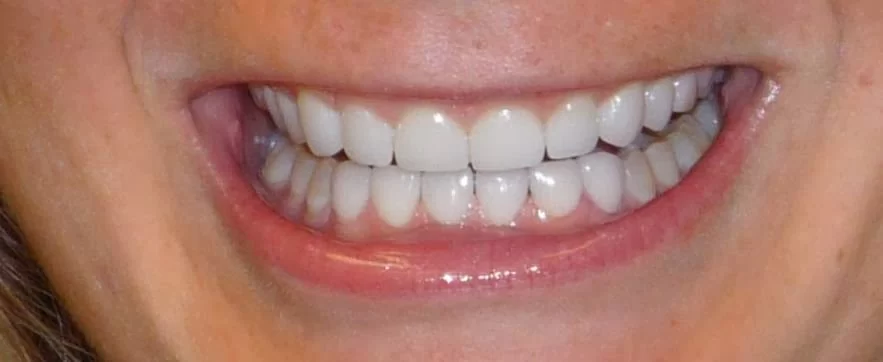 Charles Hand DDS Picture 2